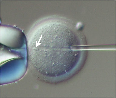 図1マウス卵子への「顕微授精」。矢印は注入された精子核。